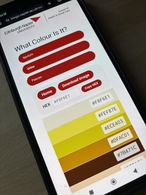 The free online tool, called What Colour Is It?, which resembles a paint colour card, with palettes of either 13 or 15 clinically-relevant colours for identifying the colour of sputum, urine and faeces. Photo: Nick Forbes/PA Wire
