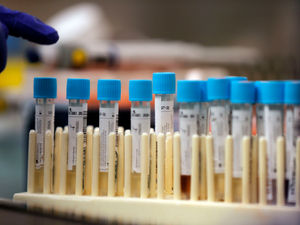 Supporting image for story: Further 15 Covid deaths confirmed at region's hospitals 