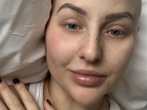 Supporting image for story: Beautician with back pain paralysed just a day after A&E discharged her with IBS medication