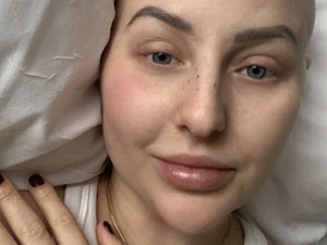 Supporting image for story: Beautician with back pain paralysed just a day after A&E discharged her with IBS medication