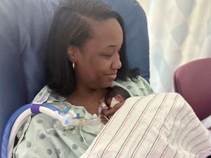 Supporting image for story: ‘Micropreemie’ baby who weighed 1lb and 1oz at birth goes home from hospital