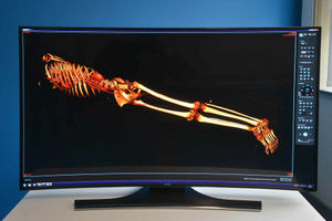 A 3D scan of a body using the technology at the £1.2m autopsy centre