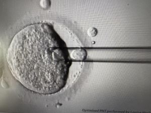 Supporting image for story: Eight babies born from pioneering IVF technique to prevent devastating disease