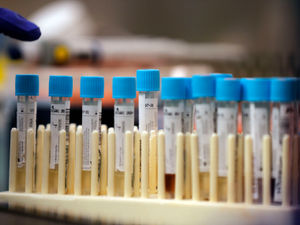 Supporting image for story: Covid cases fall but hospital admissions rise in Shropshire