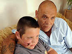 Supporting image for story: Second boy savaged in Akita dog attack