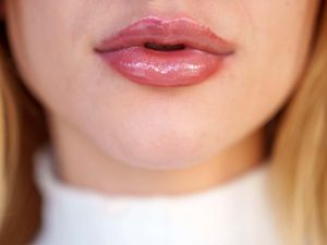 Supporting image for story: Fat injections and Brazilian butt lifts ‘offered in public toilets’, experts say