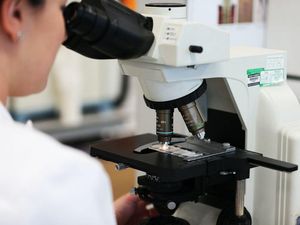 Supporting image for story: Study provides ‘vital insights’ into best time to treat Huntington’s disease