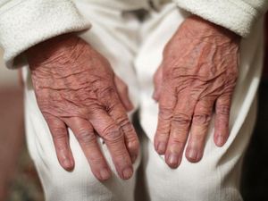 Supporting image for story: Focused ultrasound may offer new hope for Alzheimer’s disease treatment – study