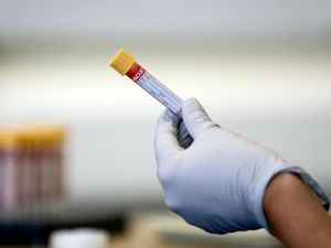 Supporting image for story: Another 13 Covid deaths confirmed in Shropshire as UK toll rises by 1,243