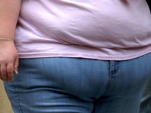 The waist of an obese woman