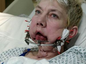 Supporting image for story