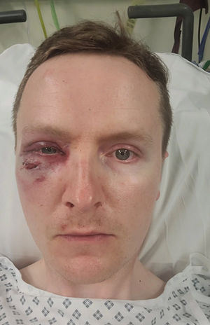 PC Ryan Davis in the aftermath of the attack.