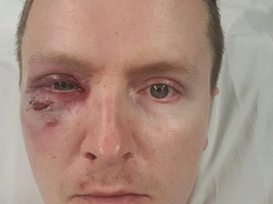 Supporting image for story: 'I thought I was going to die': Call for tougher sentences after horrific life-changing attack on West Mercia Police officer