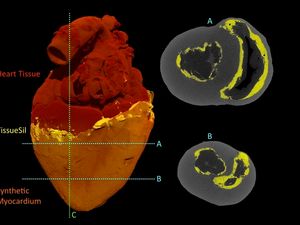 Supporting image for story