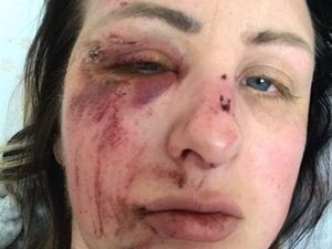 Supporting image for story: Warning to women after Telford mother suffers broken nose in late night attack 