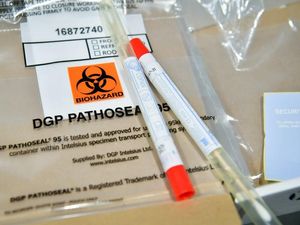 Supporting image for story: Scientists welcome escalation of Covid-19 testing in the community