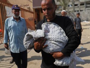 Supporting image for story: The latest child to starve to death in Gaza weighed less than when she was born