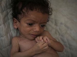 Supporting image for story: Famine grips Gaza’s largest city and is likely to spread, crisis authority says