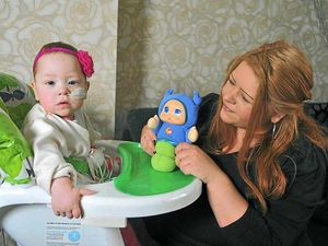 Supporting image for story: Her little body is covered in scars, but she's always smiling