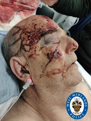 Mr Field suffered serious injuries and remains in hospital 