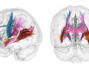 Supporting image for story: Scans show changes in brain during pregnancy