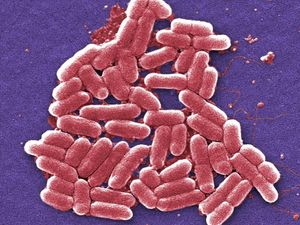 Supporting image for story: Deadly bugs give up DNA secrets to UK scientists