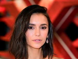 Supporting image for story: Nina Dobrev shares update after bike accident: Life looks a lil different lately
