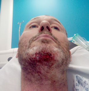 Colin Bradburn has been unable to work since the crash