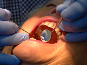 Supporting image for story: Health bosses 'hopeful' they can find dentists to fill longstanding gap in southeast Telford