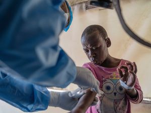 Supporting image for story: Democratic Republic of Congo begins mpox vaccinations after emergency declared