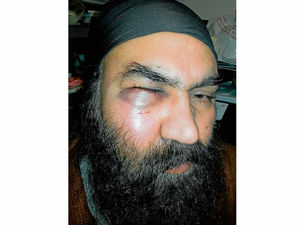 Supporting image for story: Father injured in brutal Willenhall attack