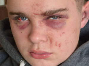 Supporting image for story: Father pledges to continue crime campaign after attack on son