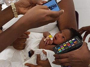 Supporting image for story: UK doctors develop low-cost jaundice detection app to check newborns