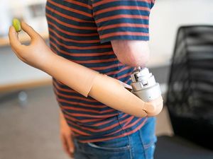 Supporting image for story: Self-contained bionic arm controlled by mind ‘could be available in two years’