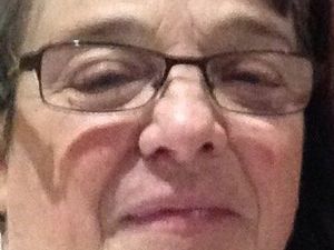 Supporting image for story: Grandmother died in crash after driver had fit at the wheel