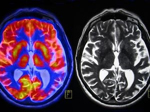 Supporting image for story: New wearable MRI-style scanners could read your thoughts