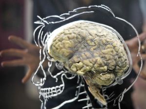 Supporting image for story: New non-invasive brain stimulation therapy hope for people with tremors