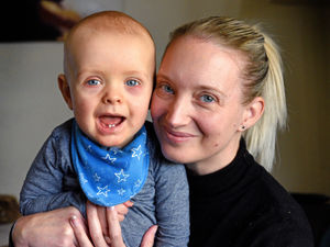 Supporting image for story: Couple raising awareness for son's rare brain condition