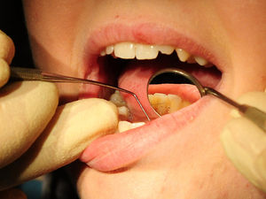 Supporting image for story: Dentists working 'tirelessly' to make practices safe