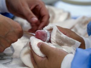 Supporting image for story: Five-day-old panda twins ‘thriving’ at Berlin Zoo