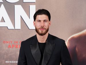 Supporting image for story: Reality stars urge Government to appoint allergy tsar to ‘prevent more deaths’