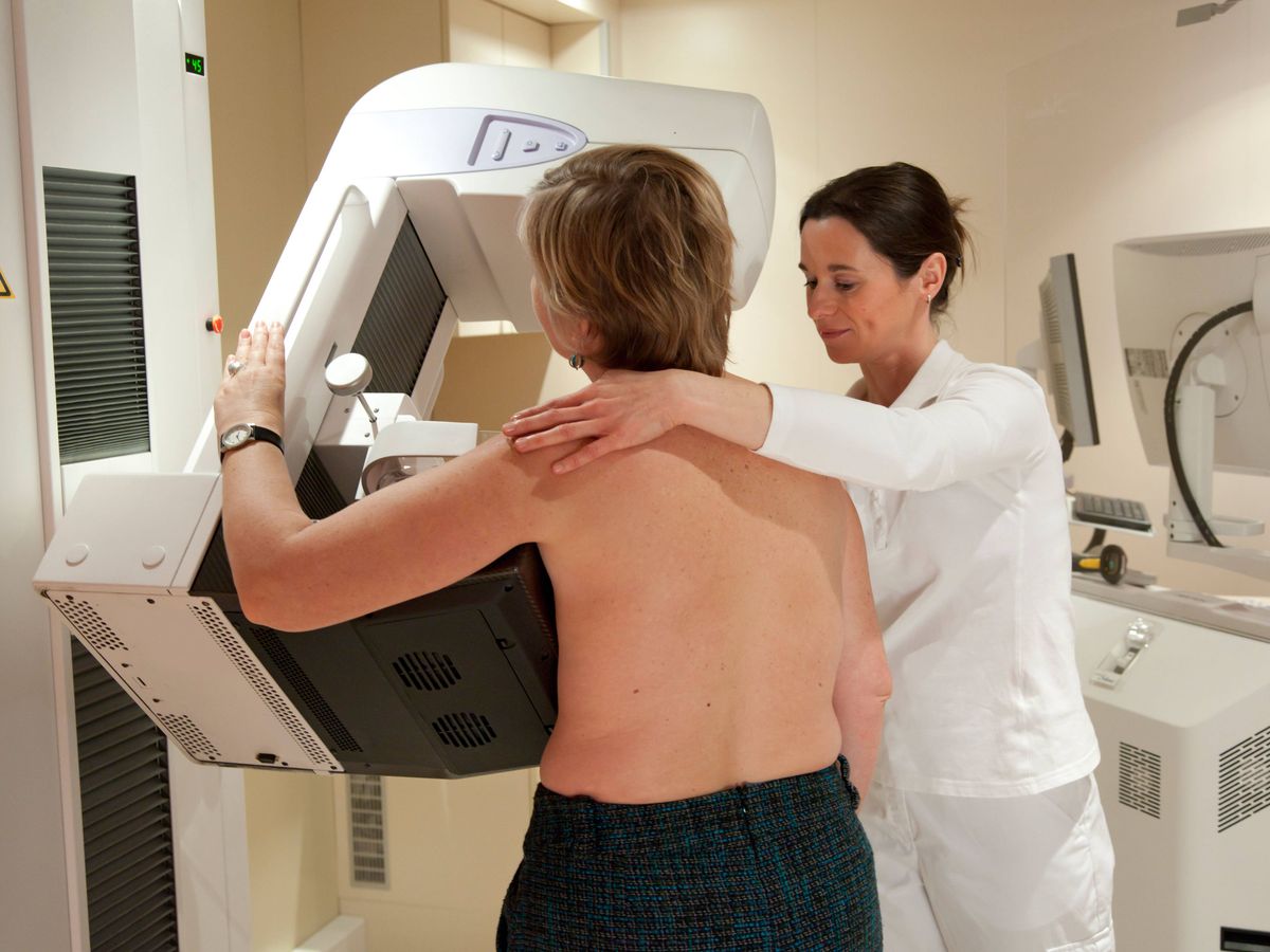 Improved breast screening could detect extra 3,500 cancers a year in UK – study