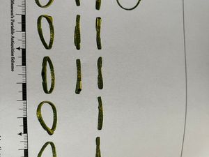 Supporting image for story: 'To my sweet love, greetings!' - Medieval ring with romantic words found in Shropshire field