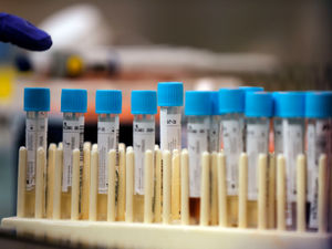 Supporting image for story: Further 27 Covid-19 deaths at hospitals in Black Country, Staffordshire and Birmingham