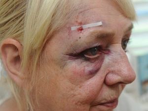 Supporting image for story: Woman attacked and taken to hospital after attempted robbery in Lichfield