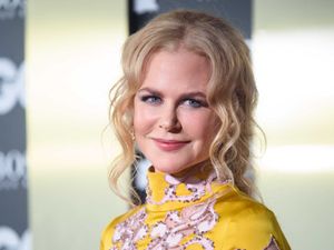 Supporting image for story: Nicole Kidman dedicates SAG Award nomination to onscreen persona Lucille Ball