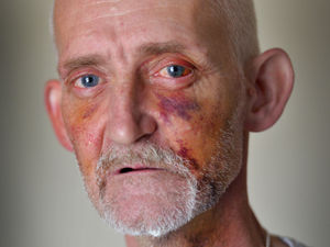 Supporting image for story: School caretaker left in fear after street beating