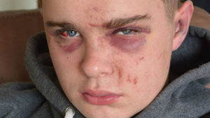 Danny Foulkes was badly injured