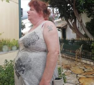 Liz before her weight loss