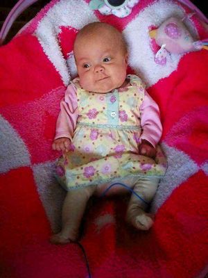 She now weighs 9 lbs and is going from strength to strength